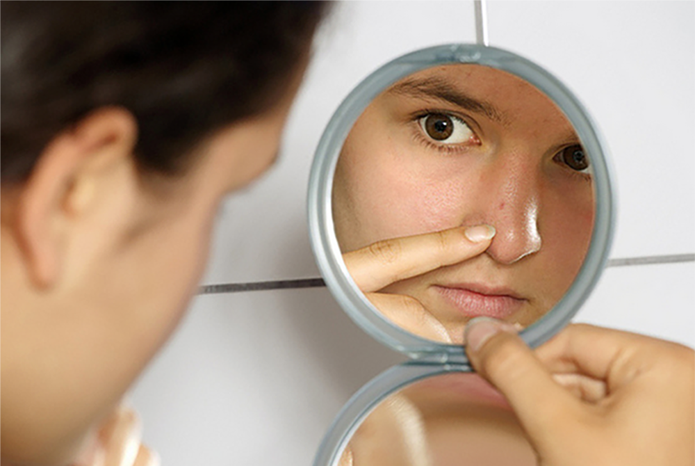 advice for pimple pickers – don’t do it!