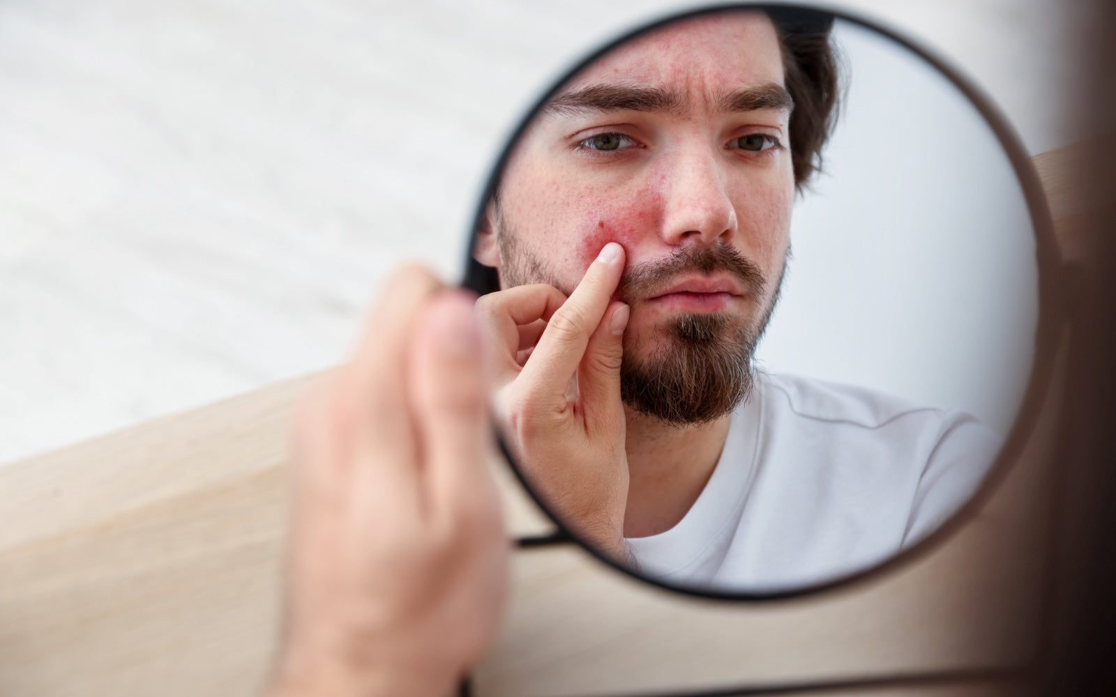 Most Acne Products Were Built For Teenage Acne. Evologie Wasn't.